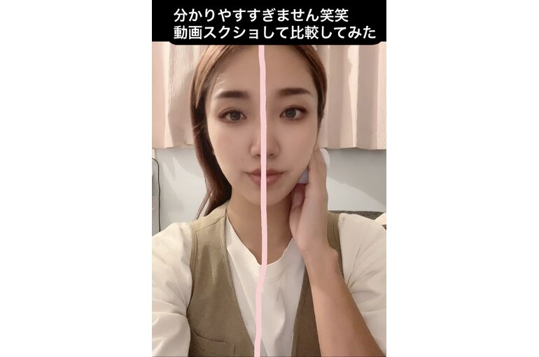 リフトアップ