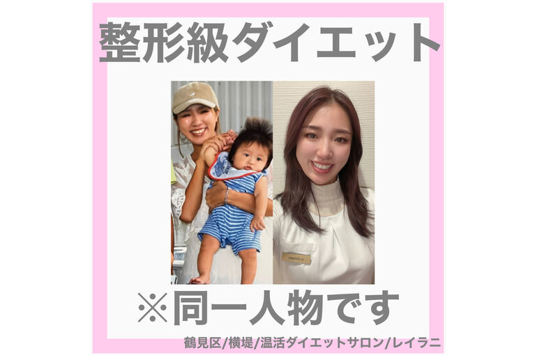 ビフォーアフター