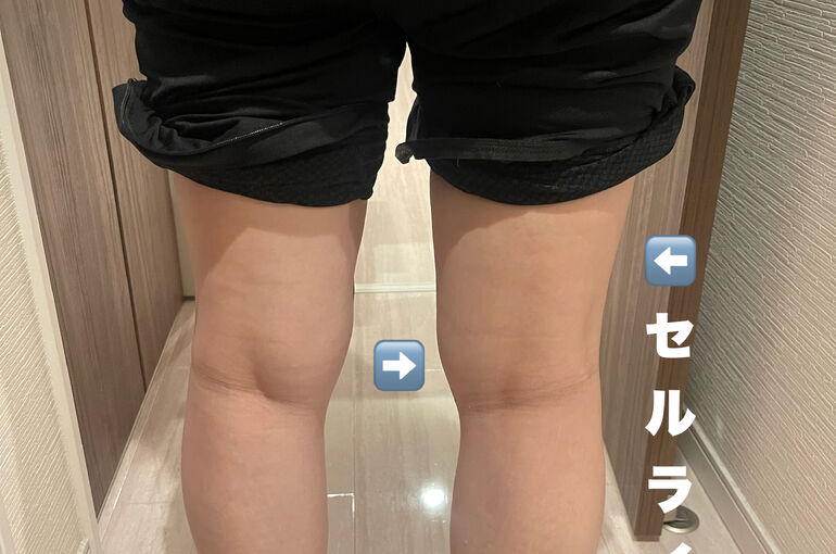 足