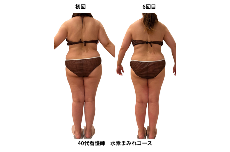 Before after