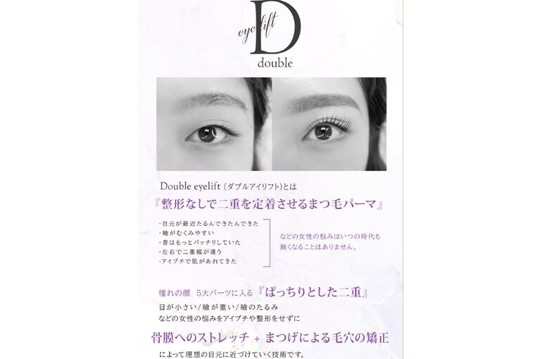 ダブルアイリフト